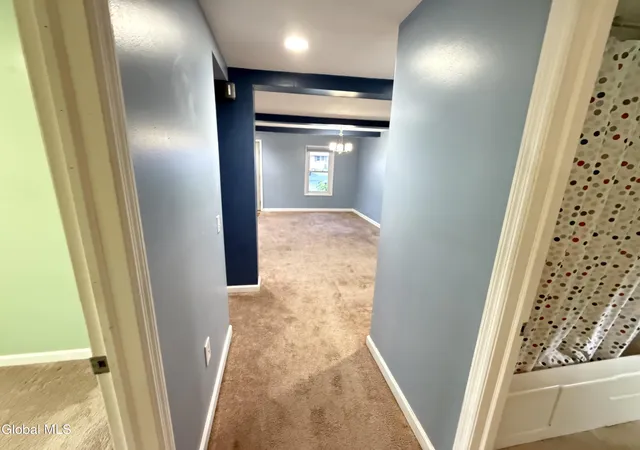Photo 4 of Single family home for sale at 1 Dunning Ave, Albany, NY 12205 | MLS# 202622478 | Listing updated on 2026-09-08