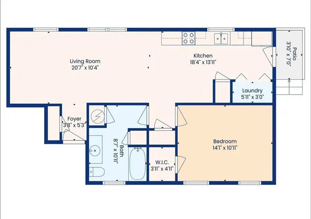 13th image of 405 07 N Tonti St, New Orleans, LA 70119 | MLS# 2567517