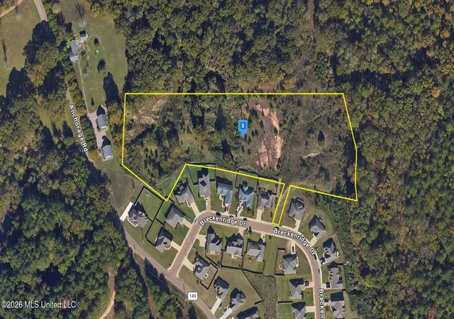 Photo 1 of Land for sale at 170 Breckenridge Dr, Oxford, MS 38655 | MLS# 4160744 | Listing updated on 2026-08-28